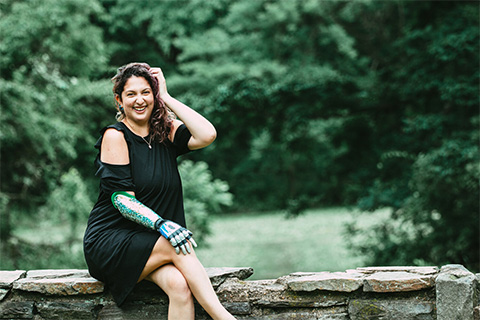 Melanie Waldman, Upper-Limb ProstheMelanie Waldman, Upper Limb Prosthetics Allcare Prosthetics Patienttics Allcare Prosthetics Patient