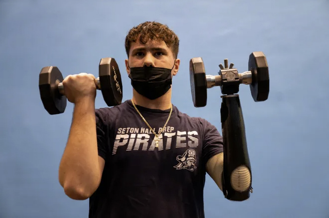 Alex Manna upper limb prosthetics weight lifting