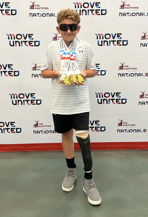 Gio Showing Off Metals, Allcare Prosthetic, Patient Spotlight