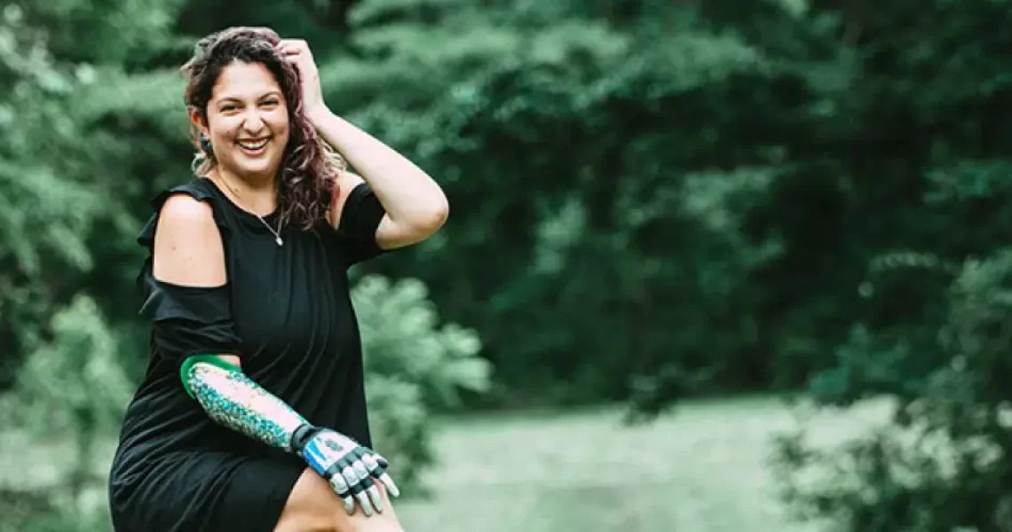 Melanie Waldman, Allcare Prosthetics Patient Spotlight